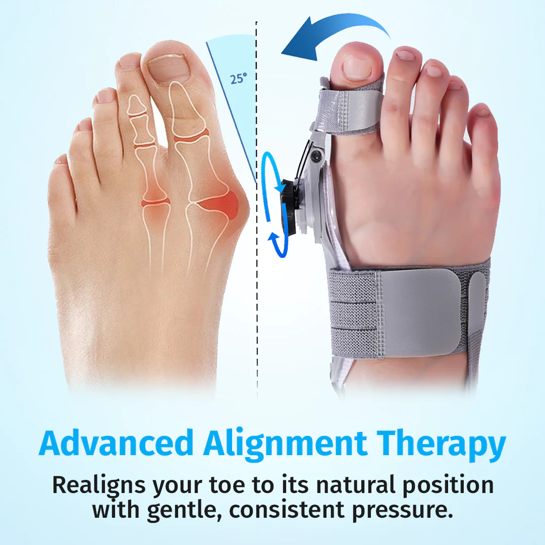Treatmedy™ Bunion Fix - Image 7