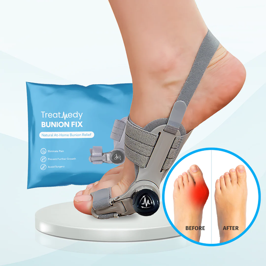 Treatmedy™ Bunion Fix - Image 9