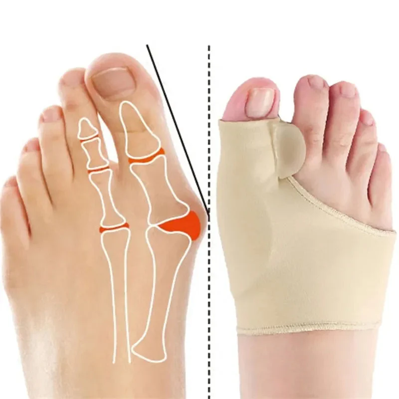 Treatmedy™ Orthopedic Daytime Bunion Sleeve - Image 4